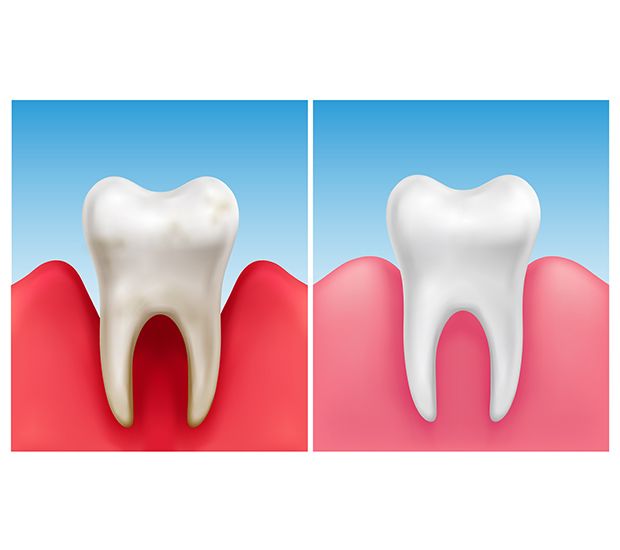 Dentist Oakland Dental Implant Center