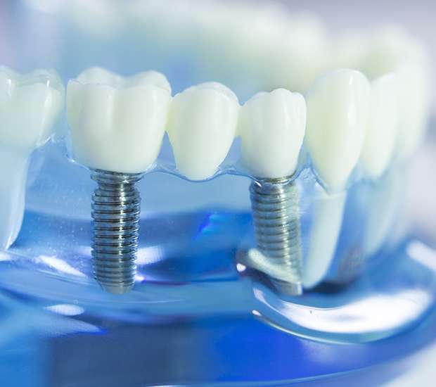 Dentist Oakland Dental Implant Center